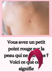 Vous avez un petit point rouge sur la peau qui ne part pas ? Voici ce que cela signifie