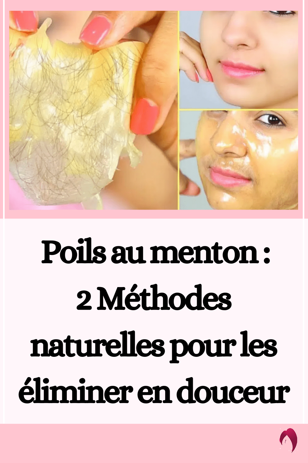 Poils au menton 2 Méthodes naturelles pour les éliminer — free download