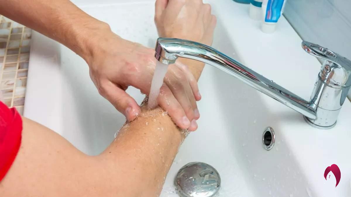 Comment soigner une brûlure à l’huile bouillante ?