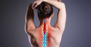 Syndrome Myofascial