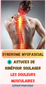 Syndrome Myofascial