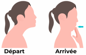 Douleurs cervicales