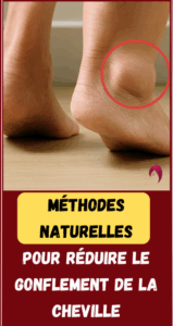Méthodes naturelles pour réduire le gonflement de la cheville