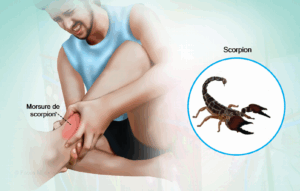 Piqûre de scorpion