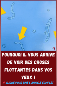 Pourquoi il vous arrive de voir des choses flottantes dans vos yeux !