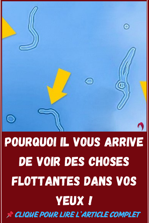 Pourquoi il vous arrive de voir des choses flottantes dans vos yeux !

