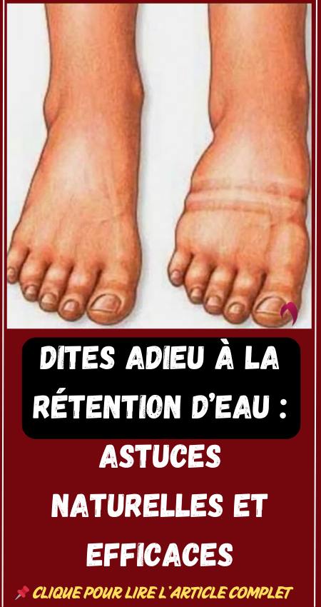 rétention d'eau