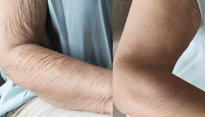 Comment prendre soin d’une peau qui vieillit naturellement