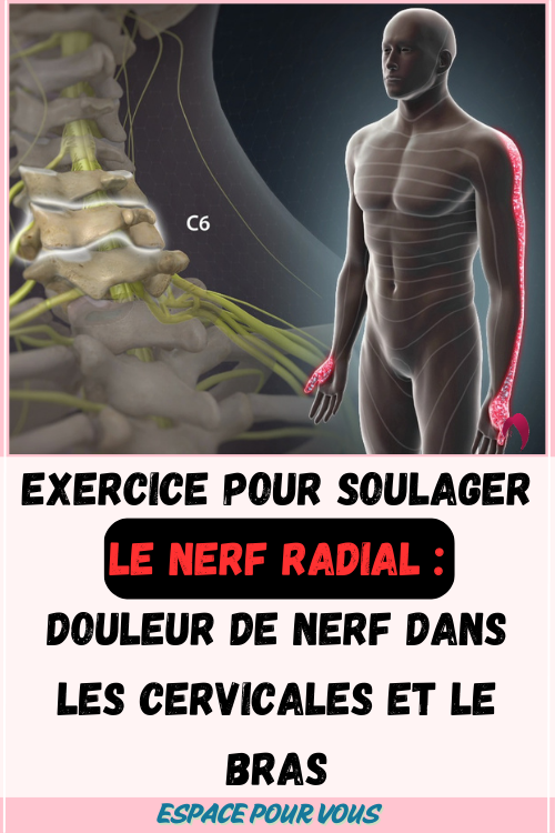Exercice pour soulager le nerf radial 