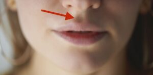 👃 Voici ce que signifie la fossette entre le nez et la lèvre supérieure